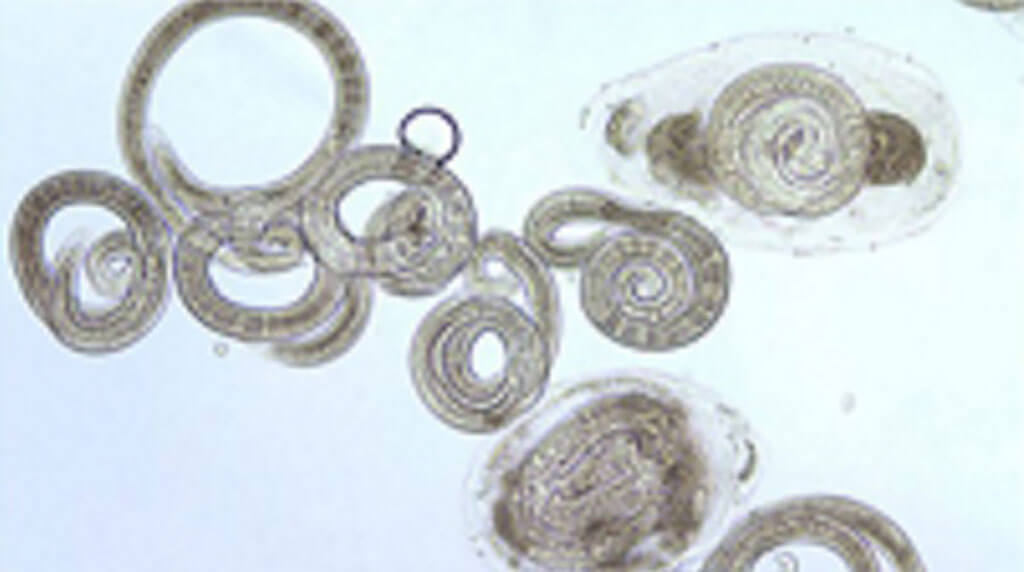 trichinellosis